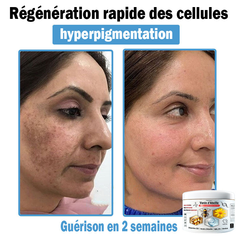 TODAH𝗢𝗙®🥥30% de réduction supplémentaire