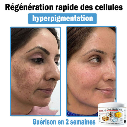 TODAH𝗢𝗙®🥥30% de réduction supplémentaire