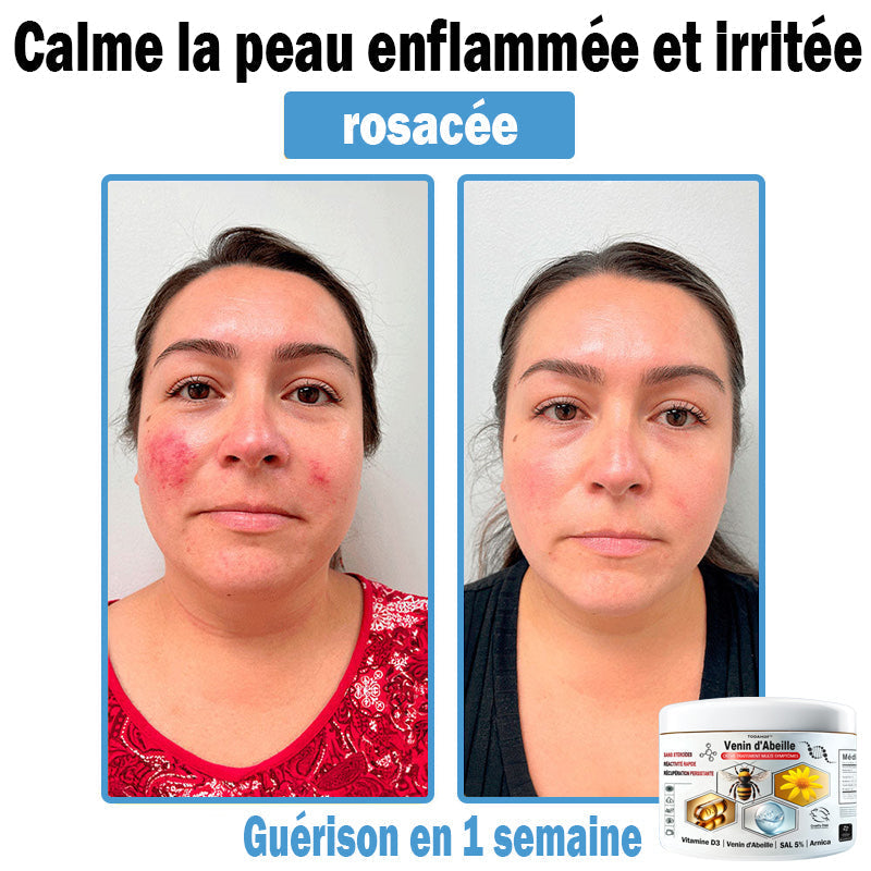 TODAH𝗢𝗙®🥥30% de réduction supplémentaire