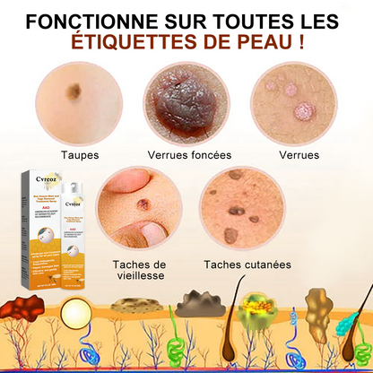🧡 Cvreoz Spray de Traitement pour l'Élimination des Verrues et des Étiquettes Cutanées au Venin d'Abeille(👨‍⚕LE DAA RECOMMANDE)🐝🐝(🔥Promotion du dernier jour 80% de réduction)