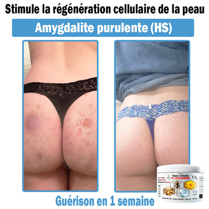 TODAH𝗢𝗙®🥥30% de réduction supplémentaire