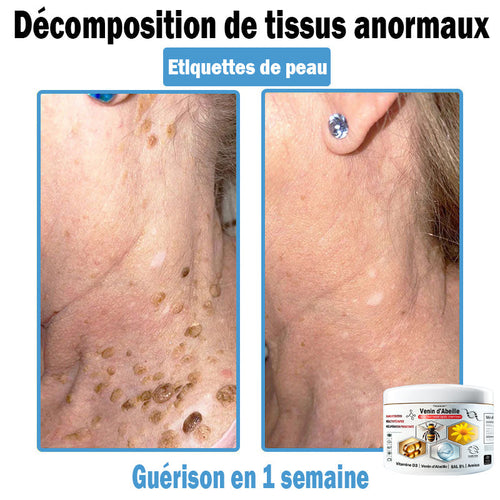 TODAH𝗢𝗙®🥥30% de réduction supplémentaire